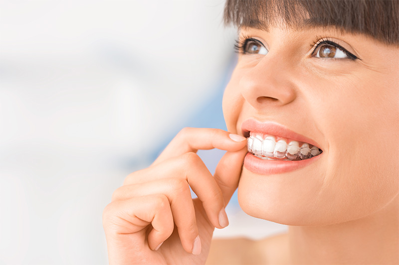 Invisalign in Ponchatoula